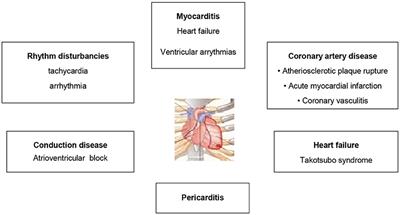 Immune Checkpoint Inhibitors and the Heart